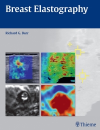 Titelbild: Breast Elastography 1st edition 9781604068528