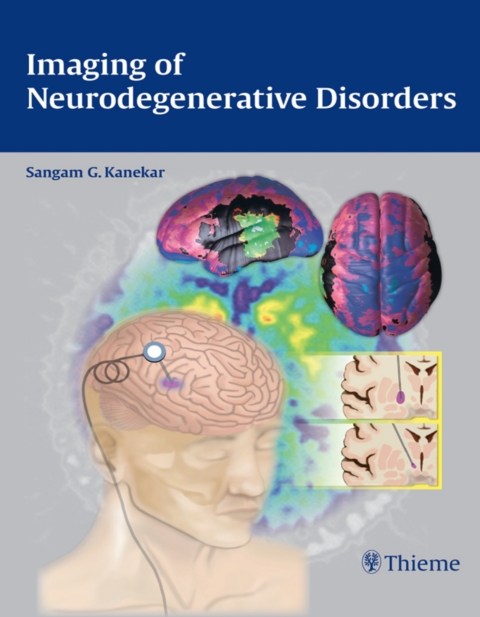 Imaging of Neurodegenerative Disorders, 1st  Edition - FULL INSTANT DOWNLOAD | PDF DOCX EPUB