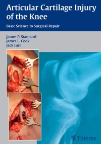 Imagen de portada: Articular Cartilage Injury of the Knee: Basic Science to Surgical Repair 1st edition 9781604068580