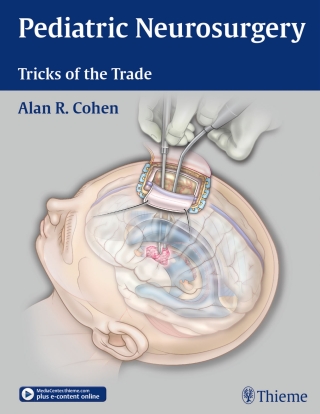 Cover image: Pediatric Neurosurgery: Tricks of the Trade 1st edition 9781604068696