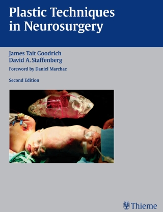 Omslagafbeelding: Plastic Techniques in Neurosurgery 2nd edition 9781588902719
