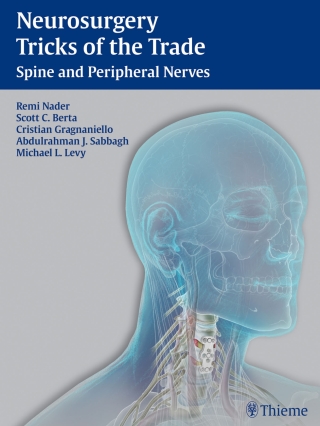 Cover image: Neurosurgery Tricks of the Trade 1st edition 9781604069143