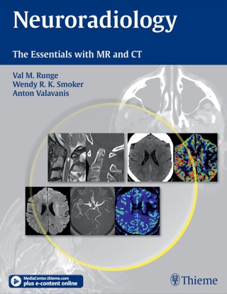 表紙画像: Neuroradiology 1st edition 9781604069174