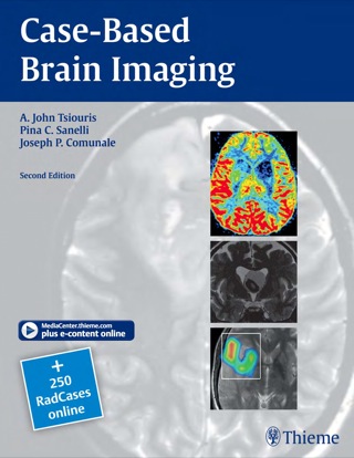Cover image: Case-Based Brain Imaging 2nd edition 9781604069532