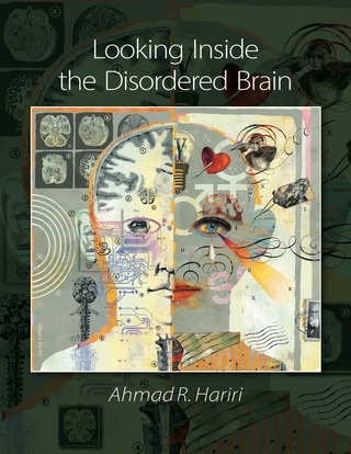 Cover image: Looking Inside the Disordered Brain 9780878939794