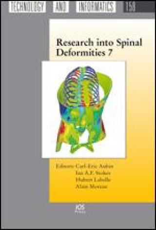 Imagen de portada: Research into Spinal Deformities 7 1st edition 9781607505723