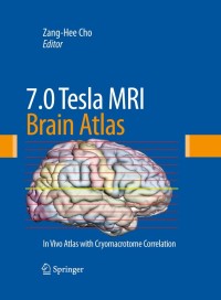 Omslagafbeelding: 7.0 Tesla MRI Brain Atlas 2nd edition 9781607611530