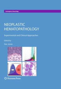 Imagen de portada: Neoplastic Hematopathology 1st edition 9781607613831