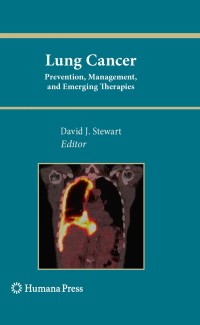 Imagen de portada: Lung Cancer: 1st edition 9781607615231