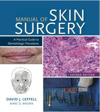 Cover image: Manual of Skin Surgery 2nd edition 9781607951582