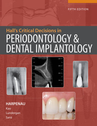 Cover image: Hall's Critical Decisions in Periodontology & Dental Implantology, 5e 4th edition 9781607950462