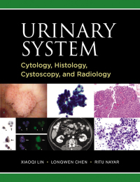 Omslagafbeelding: Urinary System: Cytology, Histology, Cystoscopy, and Radiology 9781607951858