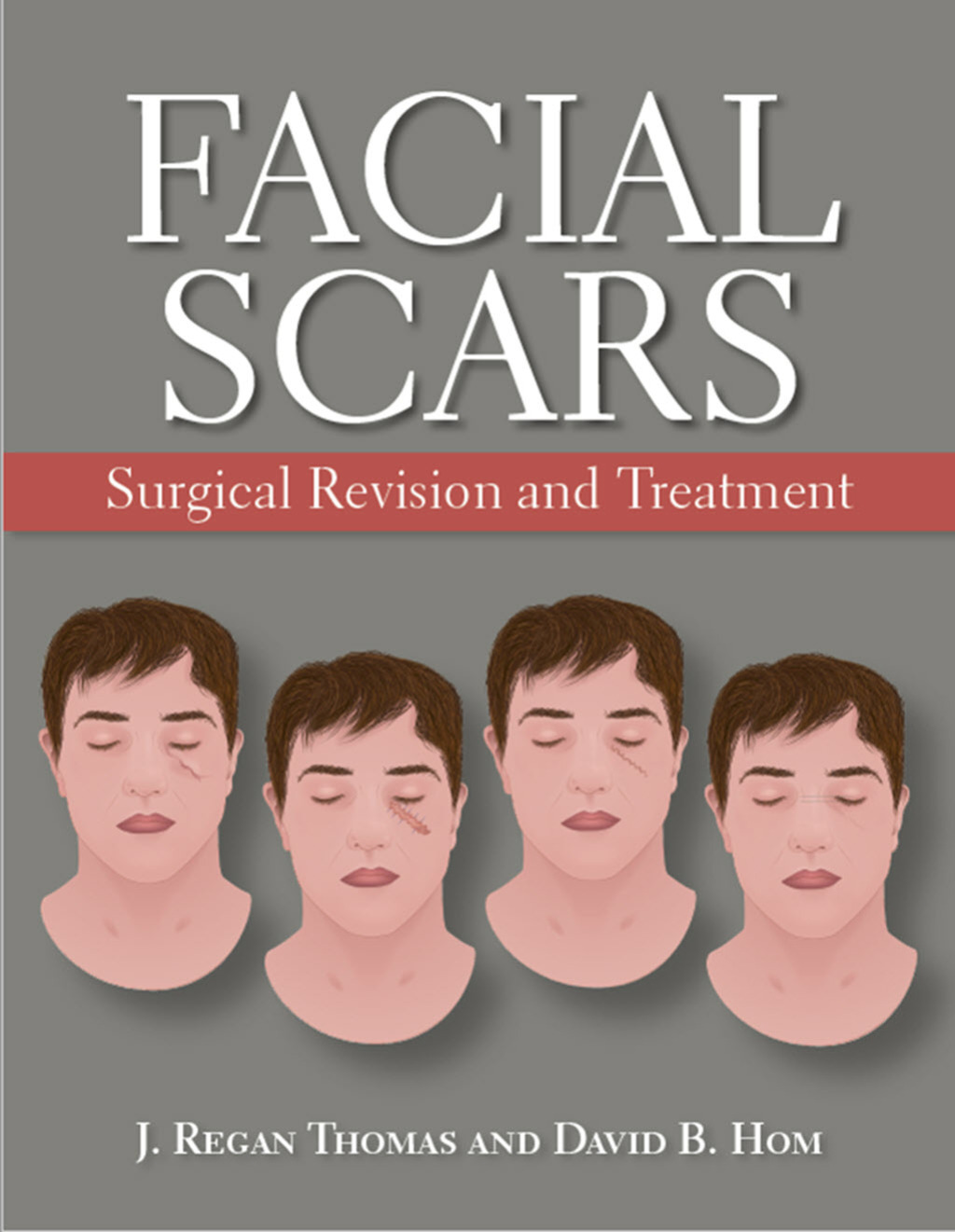 ISBN 9781607951865 product image for Facial Scars (eBook) | upcitemdb.com
