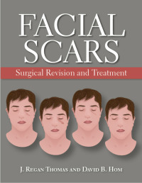 Cover image: Facial Scars 9781607951865