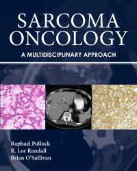 Cover image: Sarcoma Oncology 9781607950172