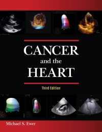 صورة الغلاف: Cancer and the Heart 3rd edition 9781607952978
