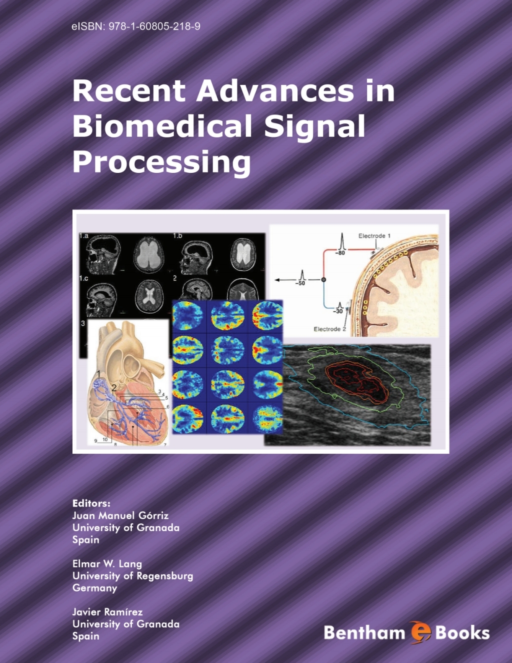 Recent Advances in Biomedical Signal Processing 1st Edition