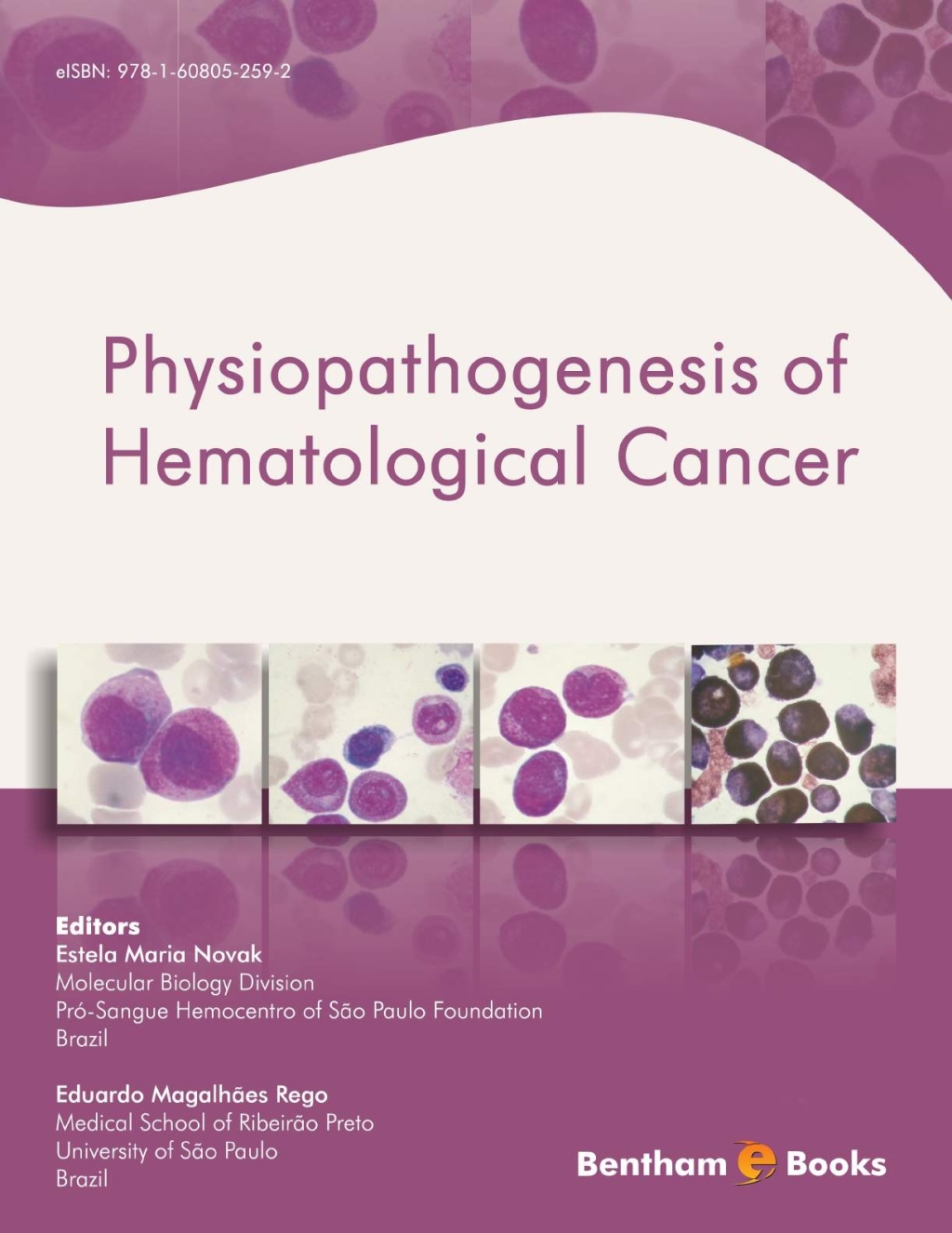 Physiopathogenesis of Hematological Cancer 1st Edition