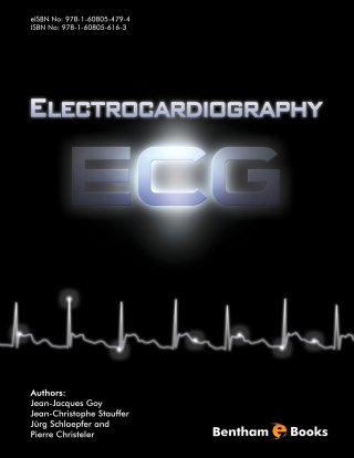 Cover image: Electrocardiography (ECG) 1st edition 9781608056163
