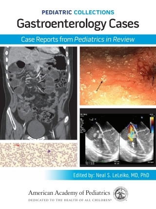 Cover image: Pediatric Collections: Gastroenterology Cases: Case Reports from Pediatrics in Review 9781610027717