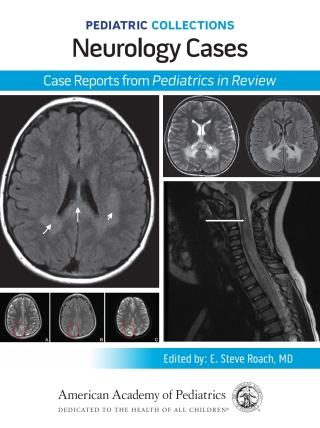 Cover image: Pediatric Collections: Neurology Cases: Case Reports from Pediatrics in Review 9781610027731