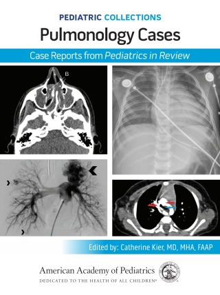 Cover image: Pediatric Collections: Pulmonology Cases: Case Reports from Pediatrics in Review 9781610028165