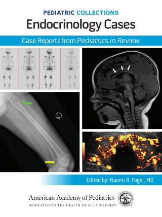 Cover image: Pediatric Collections: Endocrinology Cases: Case Reports from Pediatrics in Review 9781610028301