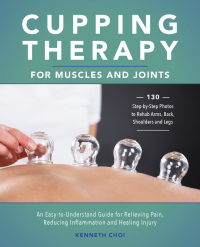 Cover image: Cupping Therapy for Muscles and Joints 9781612437972