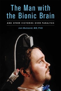 Omslagafbeelding: The Man with the Bionic Brain 9781613740552