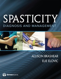 Omslagafbeelding: Spasticity 1st edition 9781933864518