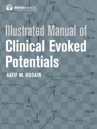 Cover image: Illustrated Manual of Clinical Evoked Potentials 1st edition 9781933864723