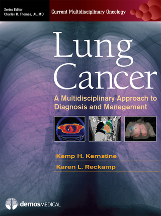 Cover image: Lung Cancer 1st edition 9781936287062