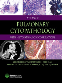 صورة الغلاف: Atlas of Pulmonary Cytopathology 1st edition 9781936287161