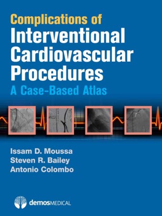 Cover image: Complications of Interventional Cardiovascular Procedures 1st edition 9781936287185