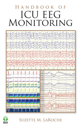 Immagine di copertina: Handbook of ICU EEG Monitoring 1st edition 9781936287390