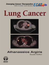 Cover image: Lung Cancer 1st edition 9781936287529