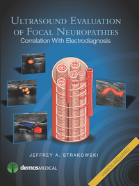 Omslagafbeelding: Ultrasound Evaluation of Focal Neuropathies 1st edition 9781936287673