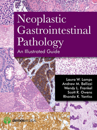 Omslagafbeelding: Neoplastic Gastrointestinal Pathology: An Illustrated Guide 1st edition 9781936287727
