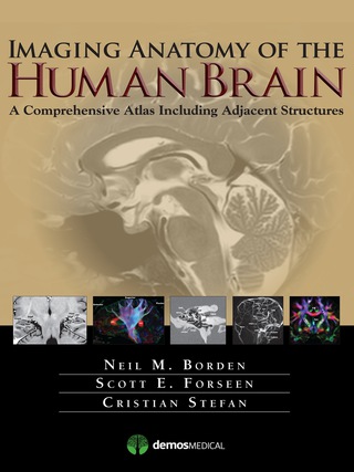 Imaging Anatomy of the Human Brain 1st edition | 9781936287741 ...