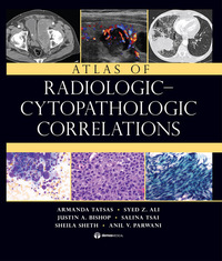 表紙画像: Atlas of Radiologic-Cytopathologic Correlations 1st edition 9781936287697