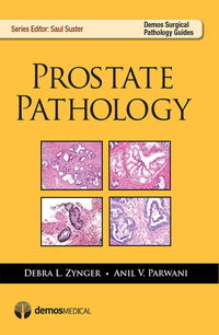 Immagine di copertina: Prostate Pathology 1st edition 9781936287901