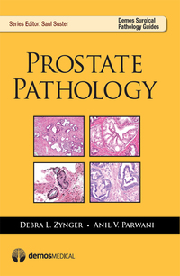 Cover image: Prostate Pathology 1st edition 9781936287901