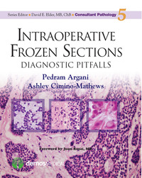 Imagen de portada: Intraoperative Frozen Sections 1st edition 9781936287970