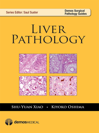 Cover image: Liver Pathology 1st edition 9781620700075