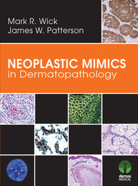 Cover image: Neoplastic Mimics in Dermatopathology 1st edition 9781620700129