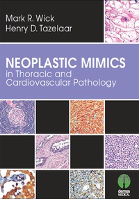 Cover image: Neoplastic Mimics in Thoracic and Cardiovascular Pathology 1st edition 9781620700136