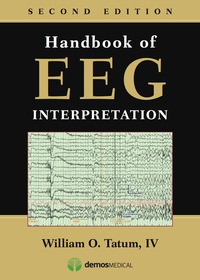 Cover image: Handbook of EEG Interpretation 2nd edition 9781620700167