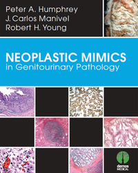 Titelbild: Neoplastic Mimics in Genitourinary Pathology 1st edition 9781620700204