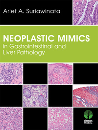 Cover image: Neoplastic Mimics in Gastrointestinal and Liver Pathology 1st edition 9781620700365