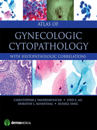 Imagen de portada: Atlas of Gynecologic Cytopathology 1st edition 9781620700440